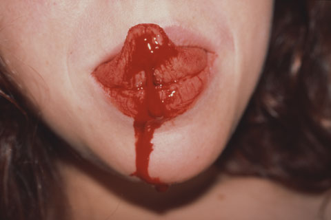 leech, tongue